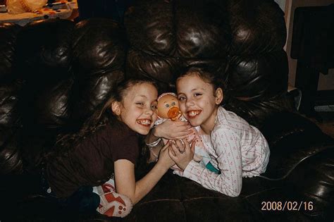 Former conjoined twin recalls sisters death at age 13